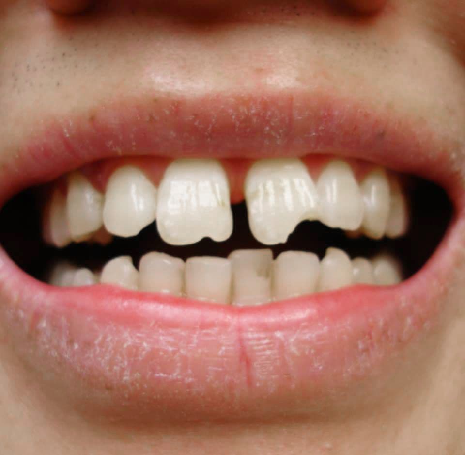 Trước điều trị