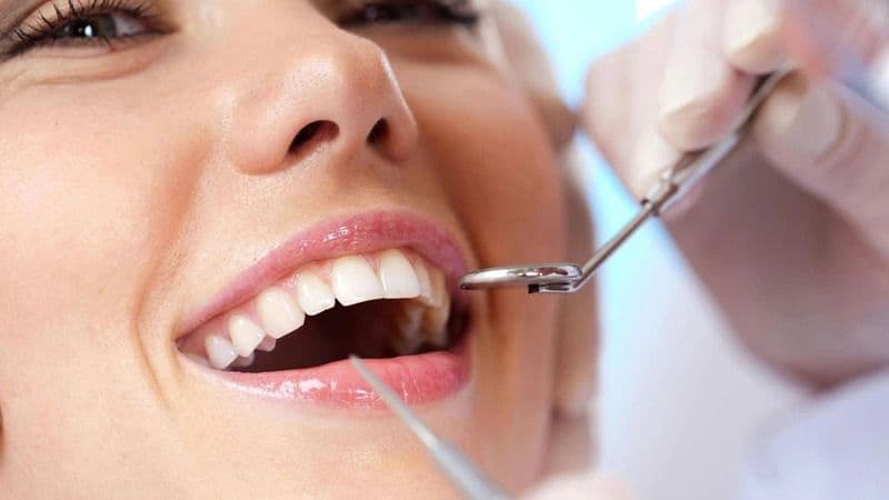 Niềng răng trong suốt cho Teen